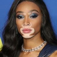 Winnie Harlow